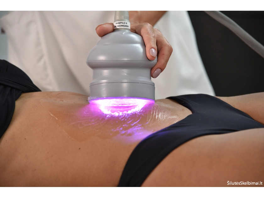  Transformuok savo kūną be skausmo su Mia Body Quantum